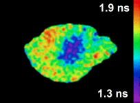 Fluorescence Lifetime Imaging Microscopy (FLIM)